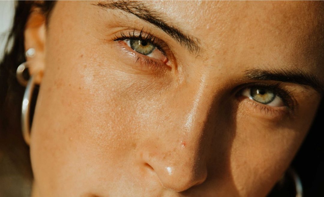 ¿Cómo bajar la hinchazón de los ojos?