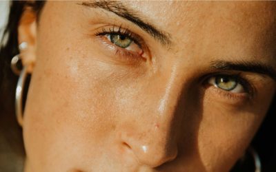 ¿Cómo bajar la hinchazón de los ojos?